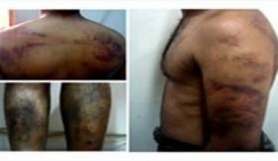 العثورعلى ناشط سياسي معذب كهربيا مجرد من ملابسه ومصاب بغيبوبة بالمحلة الكبرى 