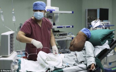 رجل صيني يعاني أصعب حالة في العالم .. صور