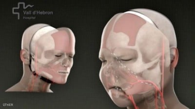 أطباء يتحضرون لعملية 