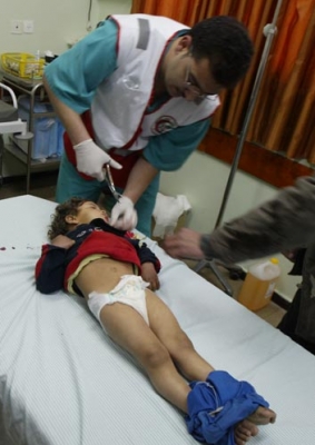 صور أطفال جرحى يتلقون العلاج في قطاع غزة
