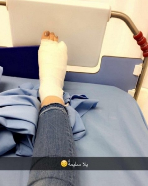 . لينا قيشاوي تكسر رجلها وتدخل المستشفى 3910696262