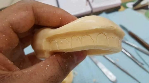 ما فعله طبيب أسنان بقالب صابون يثير الدهشة 3910735324