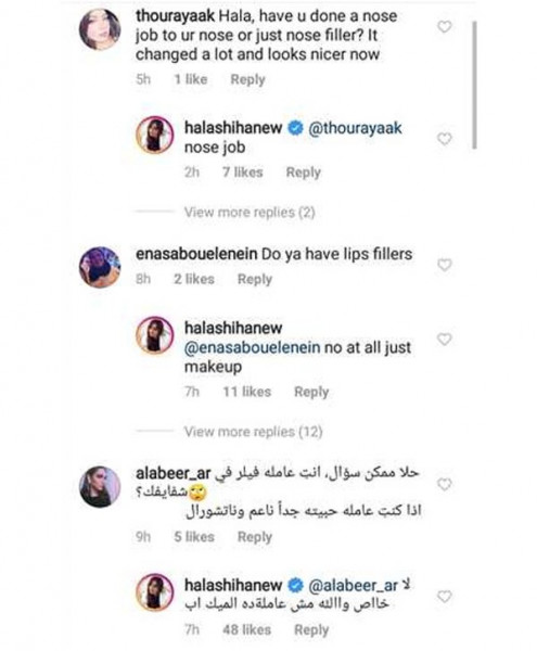 الفنانة حلا شيحة تشارك جمهورها بمجموعة صور حديثة لها الفنانة حلا شيحة تشارك جمهورها بمجموعة صور حديثة لها