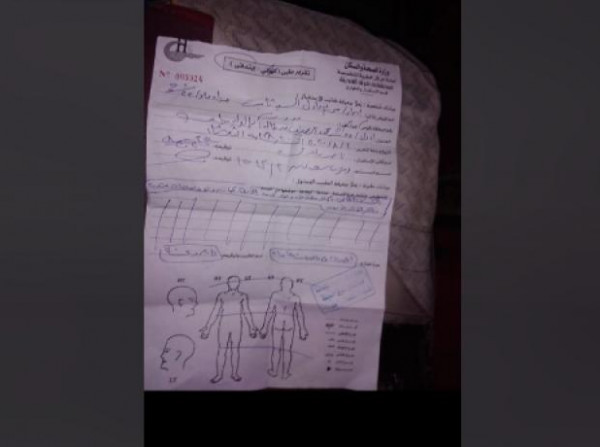 صور: "مريم" تتهم زوجها بالاعتداء عليها وابنتها: "بعت صوري الخاصة للشباب" 3911108332