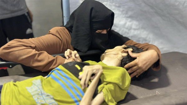 وفاة شاب في غزة بسبب سوء التغذية والتجويع الإسرائيلي المستمر