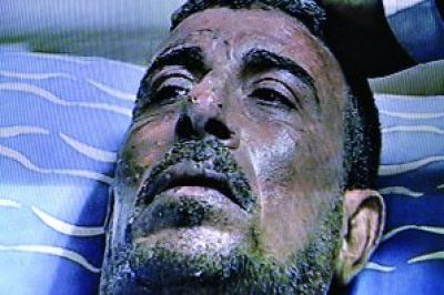 حوادث إحراق النفس احتجاجاً تمتد إلى مصر والجزائر وموريتانيا