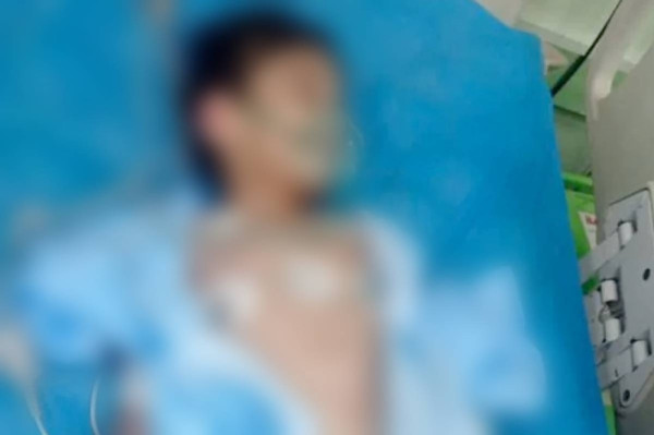 بعد موسى.. طفل عراقيٌّ جديد يقع ضحية زوجة أبيه بتعذيب مروّع