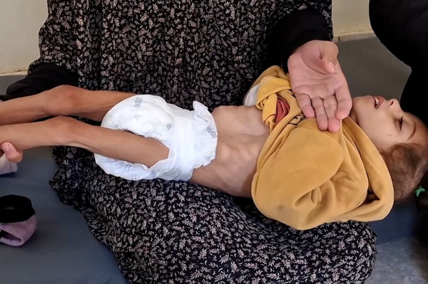 (يونيسف): عشرات الأطفال في قطاع غزة فقدوا حياتهم بسبب سوء التغذية
