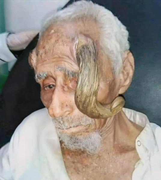 لسبب صادم.. المعمر اليمني ذي القرنين يودع الحياة بعد 140 عاماً