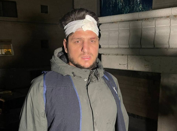 إصابة صحفي خلال مواجهات مع قوات الاحتلال في بلدة نعلين