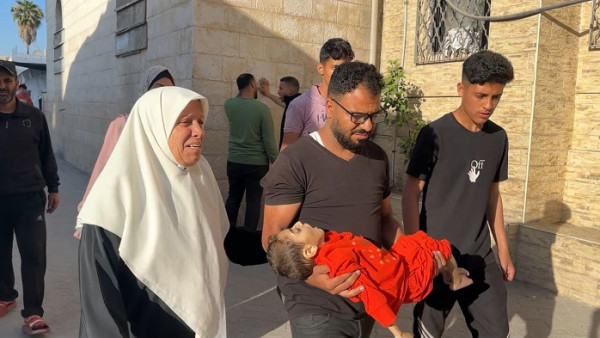 وفاة طفل في غزة بسبب سوء التغذية