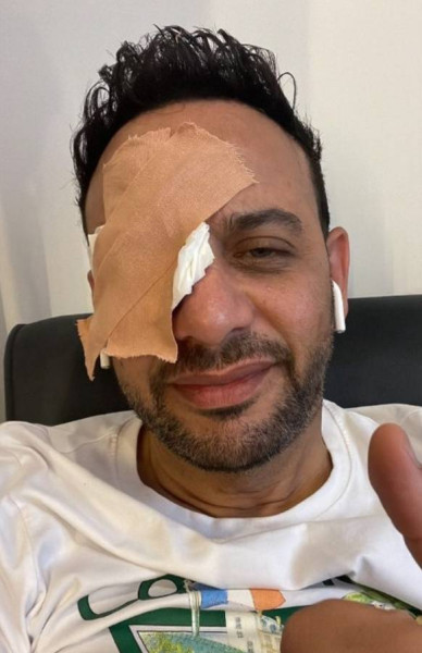 تفاصيل إصابة مصطفى قمر خلال تصوير فيلم "أولاد حريم كريم"