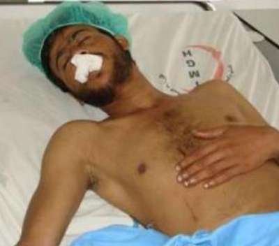 الرئيس اليمني يرسل شاعرا يمنيا للعلاج في الاردن بعد قطع لسانه على يد معارضين