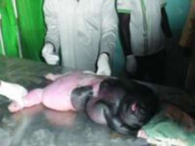 ولادة حيوان نصف بشري بنيجيريا