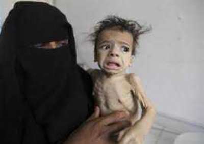 مليون طفل يمني يواجهون المجاعة في رمضان