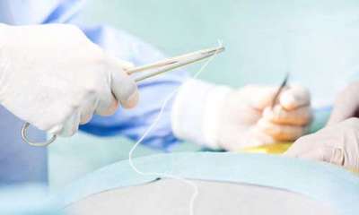 ابتكار أوعية دموية لتحسين عمليات الجراحة القلبية