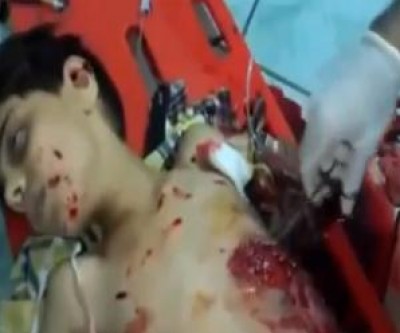 بالفيديو +18 .. طفل ينطق الشهادة ويتلو القرآن قبل موته في سوريا