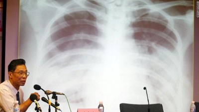 5 إصابات جديدة بفيروس "كورونا" في السعودية