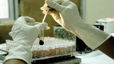 بعد ارتفاع عدد الضحايا.. تجارب مخبرية على مضادات فيروسية لمكافحة كورونا