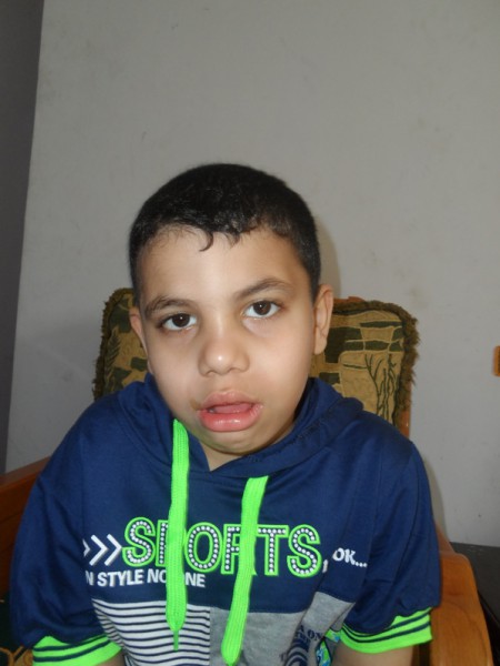 الطفل جواد نازح  من اليرموك يتصرخ لتامين العلاج لانقاذه من تدهور حالته الصحية