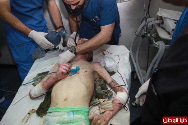 100 صورة تجمل إصابات الأيام الستة للعدوان على قطاع غزة +18