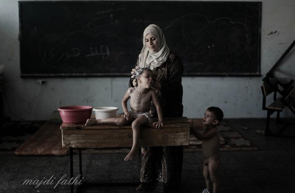 في غزة فقط