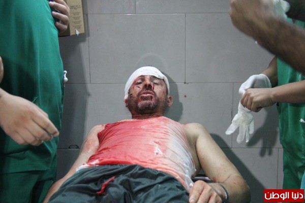 صور الإصابات الأخيرة في إستهداف منزل عائلة أبو كويك في مدينة غزة