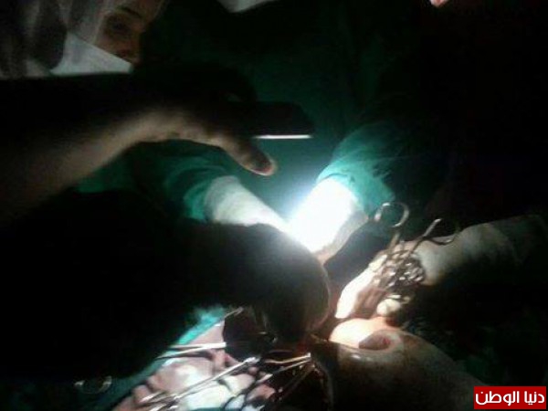 الضغط الشعبي تفتح النار على "صحة" الاسماعيلية بسبب كارثة "الكهرباء"