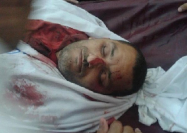 استشهاد مواطن متأثرا بجراحه في خان يونس
