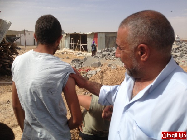 النائب طلب ابو عرار لوزير المعارف:" زودوا مدارس القرى غير المعترف بها بالملاجئ"