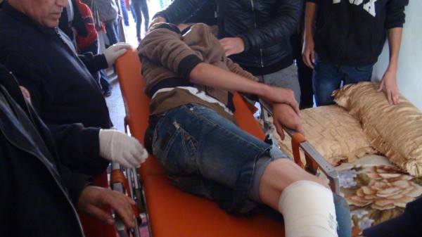 اصابة طفل بالرصاص الحي في المواجهات الاسبوعية في النبي صالح