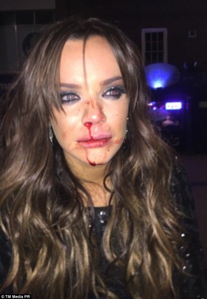 بالصور: اعتداء وحشي على عارضة الأزياء البريطانية ماريا فاولر
