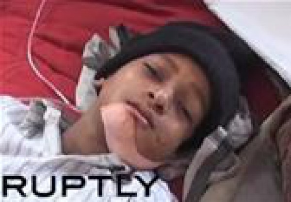 طفل هندي عمره 7 أعوام يخلع 80 سنا