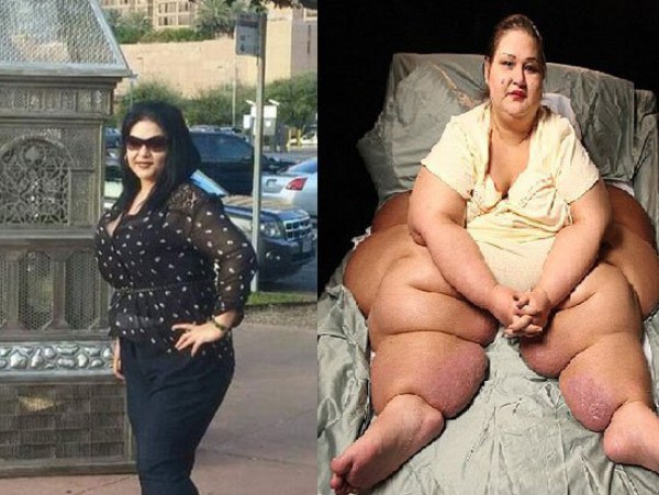 بالصور..أثقل امرأة بالعالم تخسر نصف وزنها بعد نجاتها من حكم بالإعدام