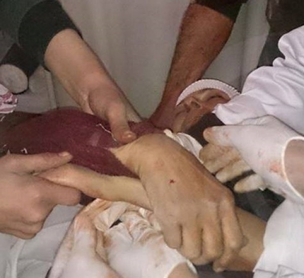 "لاجئة تقضي برصاص قناص في اليرموك، واستهداف مشفى فلسطين بالبراميل المتفجرة"