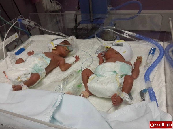 مستشفى مسلم التخصصي يجري ولادة قيصرية لسيدة لأربعة أطفال