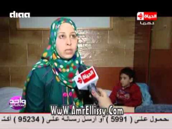 الليثى يعرض حالة طفل يعانى من إستسقا بالمخ