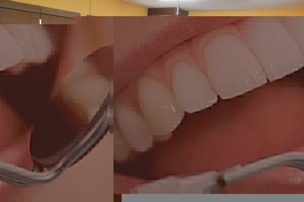 كيف يمكن إجراء جراحة أسنان فى 14 دقيقة فقط؟