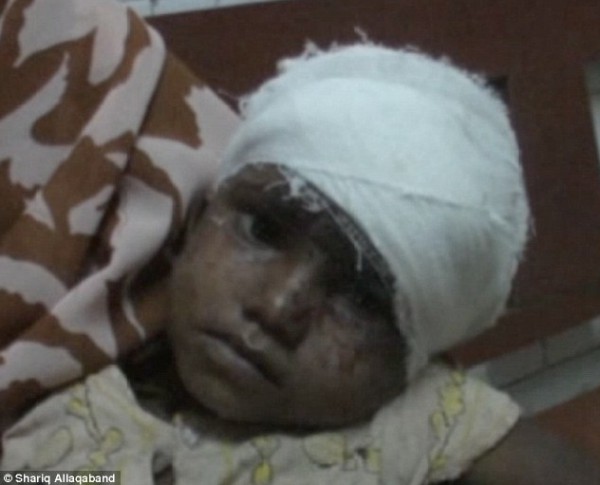 صور : أم هندية تُقطع رأس ابنتها إلى شرائح وتأكلها .. وصُراخ الطفلة أنقذها
