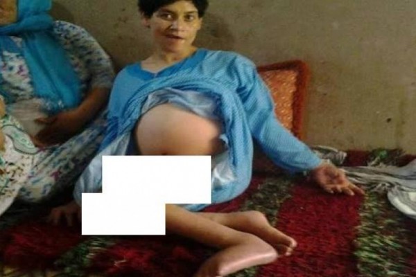 بالصور: فوزية الدمياني..  شابة مغربية مُعاقة وضعت طفلًا من مجهول استغل عجزها واغتصبها