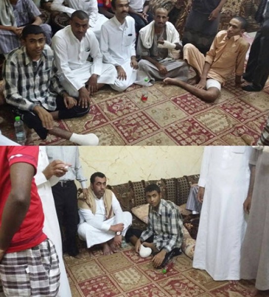 ممثل الملك سلمان يزور جرحى المقاومة الشعبية اليمنية ووزير الصحة في سبات