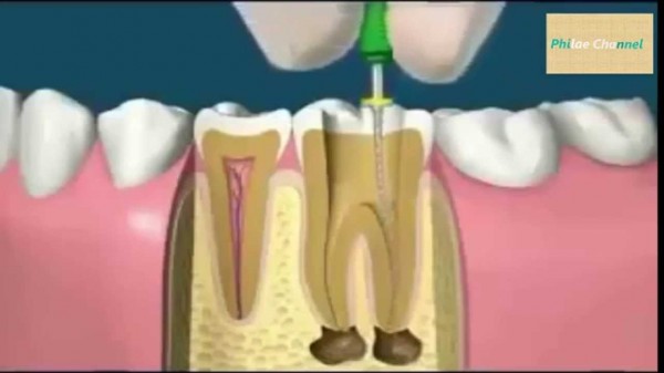 بالفيديو: للفضوليين .. شاهد ما يفعله طبيب الأسنان في فم المريض