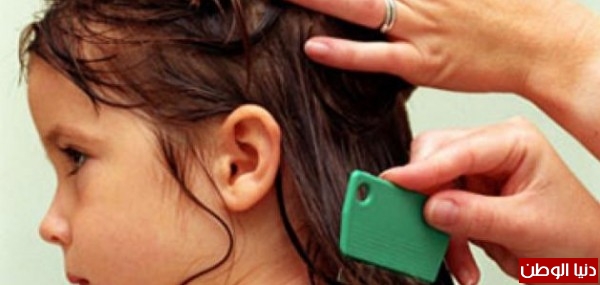 بالفيديو .. كيفية علاج الصئبان " القمل "