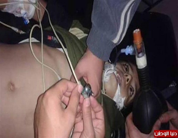 نتيجة عدم توفر الرعاية الطبية والحصار ضحايا اليرموك في تزايد
