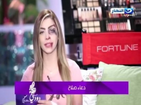 مذيعة تعرض أحد حلقاتها بعد تعرضها للعنف من قبل أخرين
