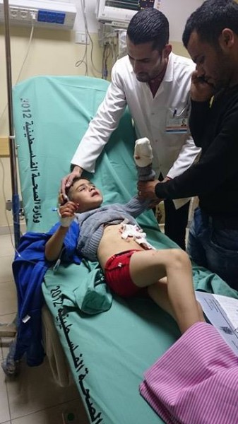 إصابة ثلاث مواطنين بينهم طفلين إثر انفجار جسم مشبوه شمال غزة