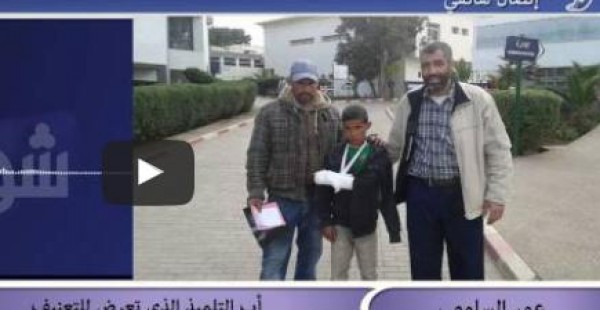 شاهد: أب تلميذ يتهم أستاذة بكسر ابنه