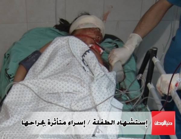 متأثرة بجراحها.. استشهاد الطفلة اسراء أبو خوصة اثر قصف اسرائيلي الليلة الماضية