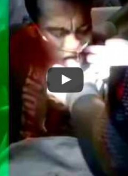 شاهد: لحظة إخراج سمكة حية من حنجرة رجل