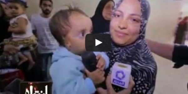 شاهد.. طفل يولد بأذن واحدة و3 ثقوب في القلب